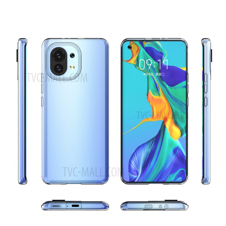 Case Xiaomi Mi 11 5G # Pre-Order * เคสป้องกัน TPU บางเฉียบใสคริสตัล *