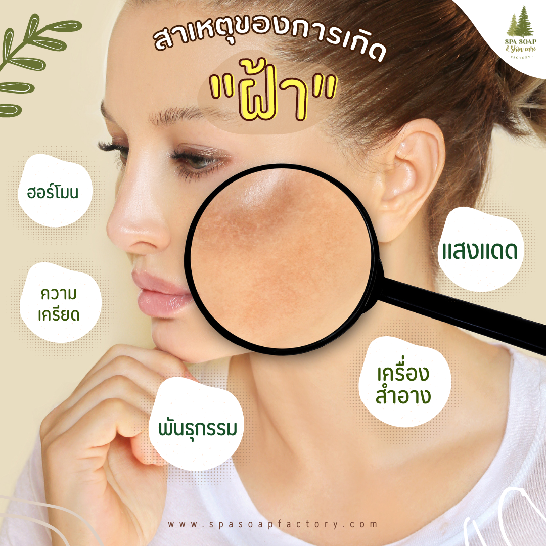 รู้จัก "ฝ้า" ปัญหาที่ไม่อยากให้เกิดบนหน้าของเรา