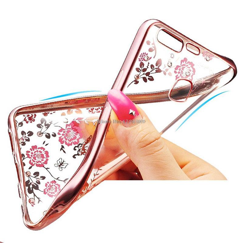 Case Huawei P9 Plus / Pre-order * เคสหรูหราเทคนิคการชุบทอง TPU ซิลิโคนอ่อนนุ่ม *