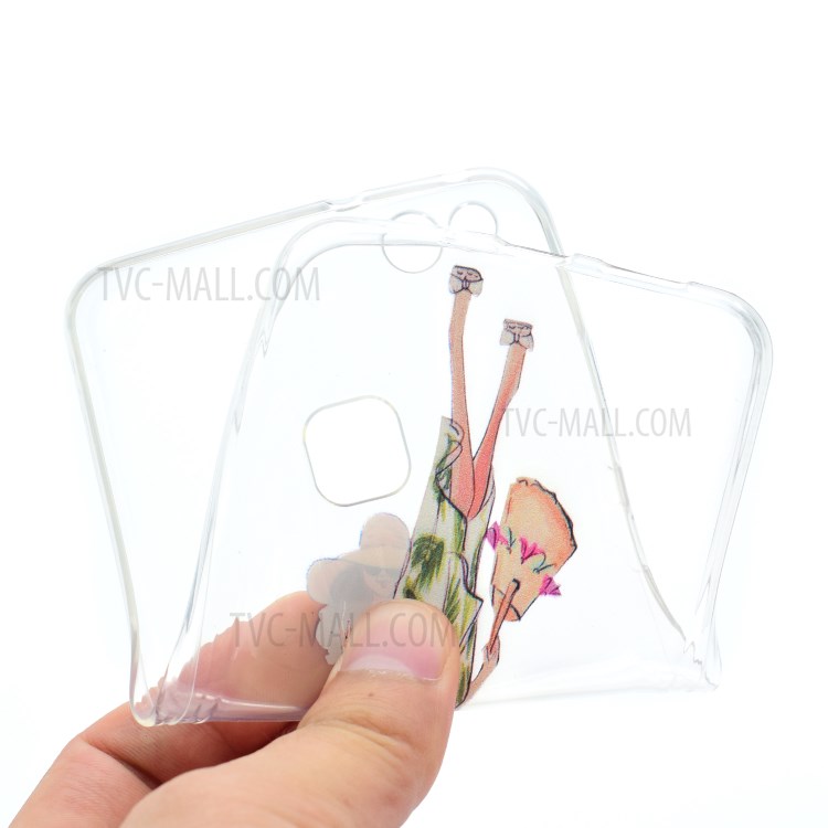 Case Huawei P10 Lite / Pre-order * บางเฉียบพิมพ์นุ่ม เคส TPU *