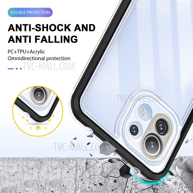 Case Xiaomi 11 Lite 5G # Pre-Order * เคสผิวลิ้นจี่เนื้อนุ่ม TPU เคสโทรศัพท์ฝาครอบป้องกัน วัสดุ TPU นุ่ม สามารถบิดได้อย่างอิสระโดยไม่แตก *