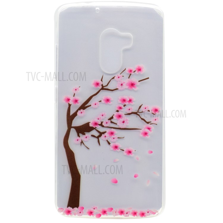 Case Lenovo A7010 / Pre-order * Soft TPU รูปแบบที่สดใสดูทันสมัย *