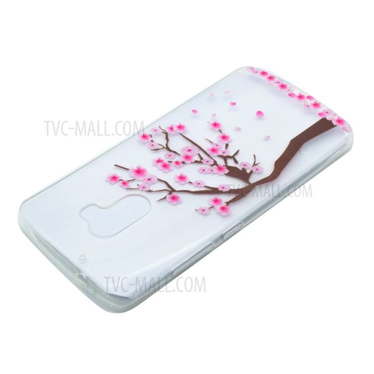 Case Lenovo A7010 / Pre-order * Soft TPU รูปแบบที่สดใสดูทันสมัย *