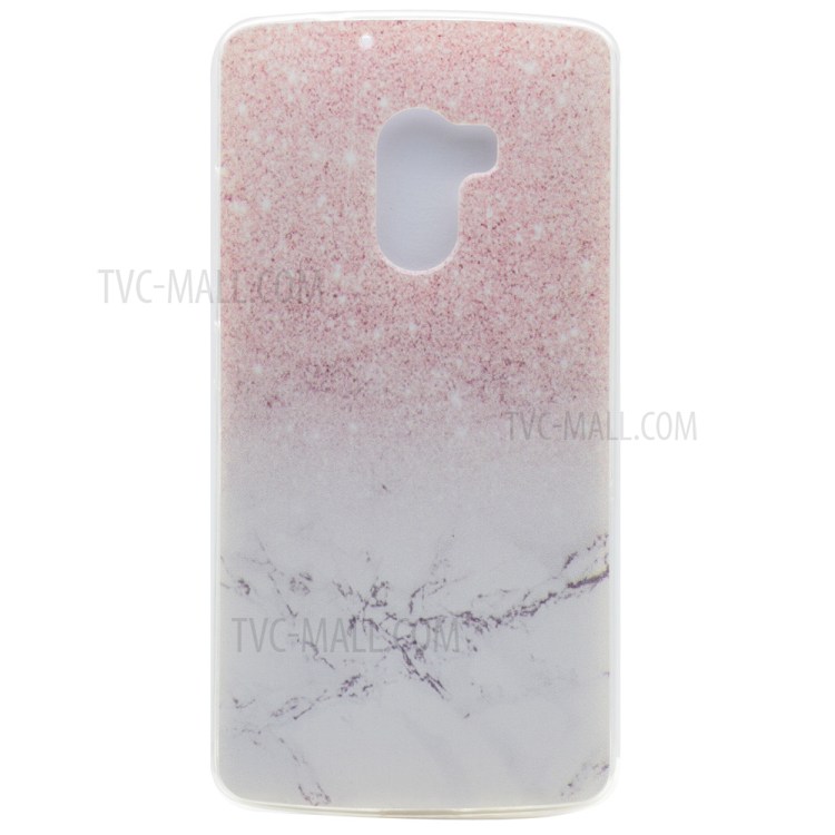 Case Lenovo A7010 / Pre-order * Soft TPU รูปแบบที่สดใสดูทันสมัย *