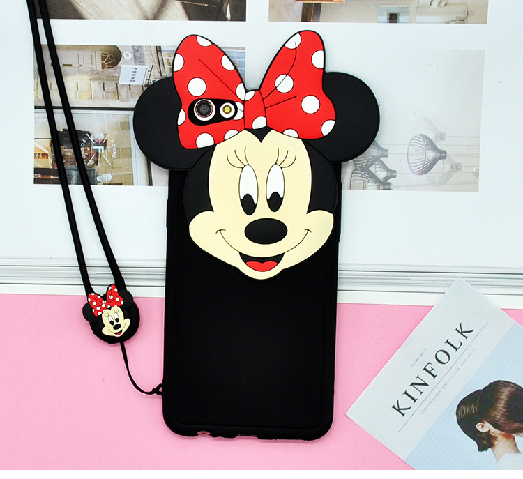 Case Huawei P10 Plus / Pre-order * 3D ซิลิโคน รูปทรง 3 มิติและน่ารัก *