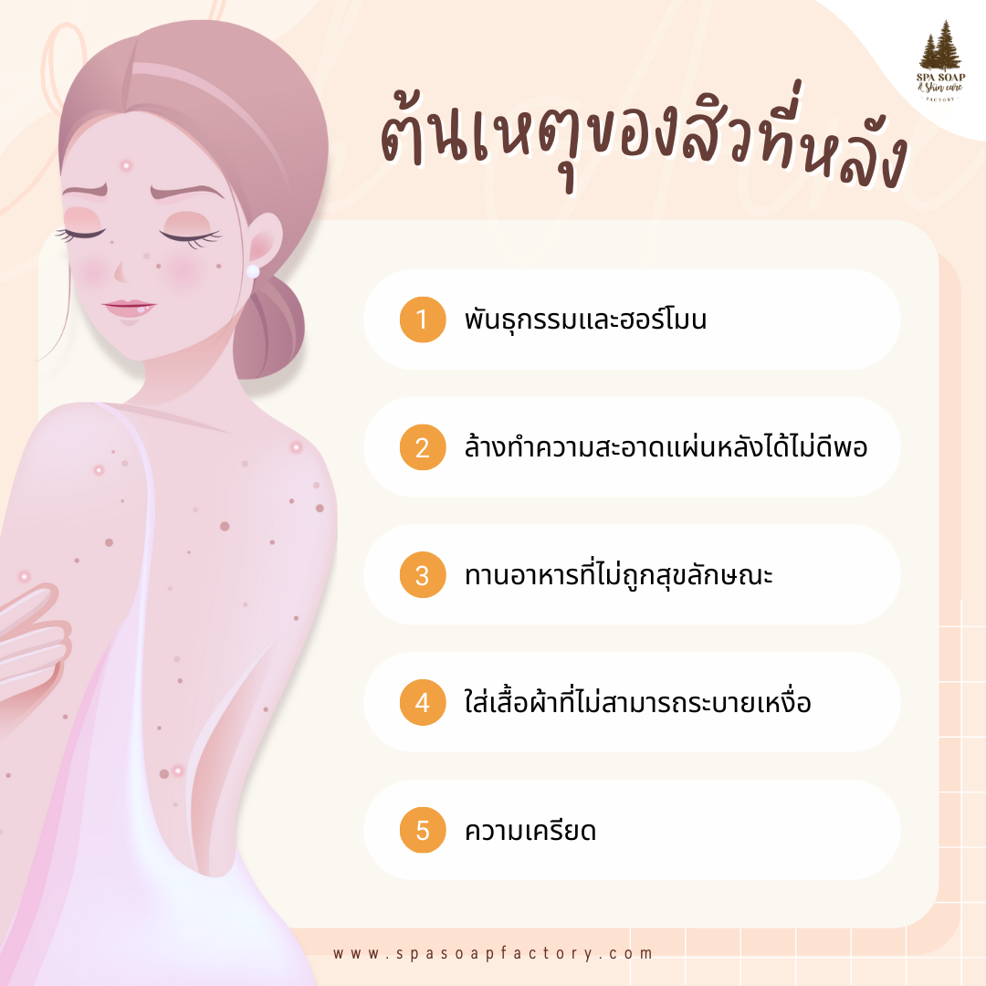 5 วิธี ทำยังไง? สิวหลังหายเกลี้ยง ไม่กลับมาเป็นซ้ำ