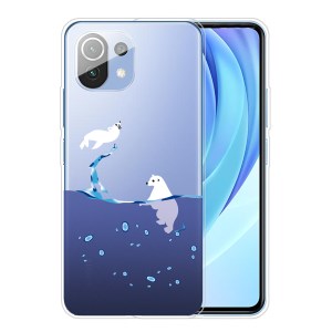 Case Xiaomi Mi 11 5G # Pre-Order * เคสโทรศัพท์พิมพ์ลาย Soft TPU ที่ได้รับการปกป้องอย่างดี *