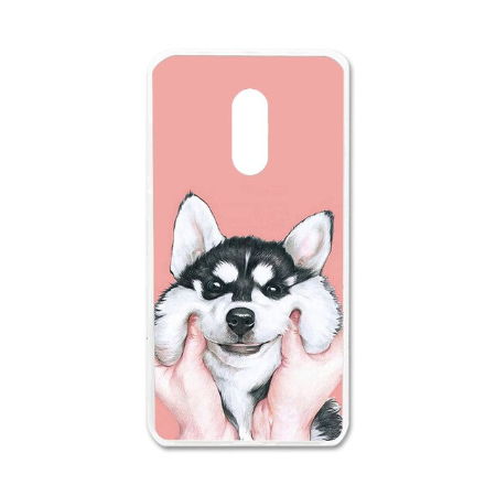 Case Lenovo K6 Note / Pre-order * Soft TPU สามารถบิดได้อย่างอิสระโดยไม่แตก *