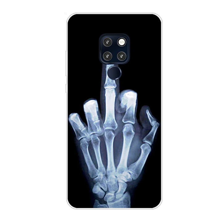 Case Huawei Mate 20 / Pre-order * เคส TPU ใสพิมพ์ลายการ์ตูนน่ารัก *