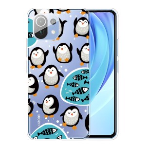 Case Xiaomi Mi 11 5G # Pre-Order * เคสโทรศัพท์พิมพ์ลาย Soft TPU ที่ได้รับการปกป้องอย่างดี *