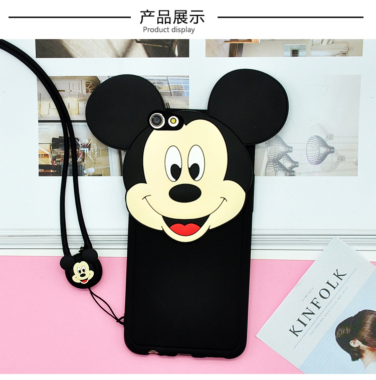 Case Huawei P10 Plus / Pre-order * 3D ซิลิโคน รูปทรง 3 มิติและน่ารัก *