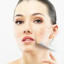 Lactic Acid (AHA) 88% 100g ผลัดผิวขาวอย่างอ่อนโยน