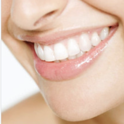 Sodium fluoride usp SRT 1kg 006068