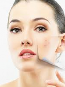 Lactic Acid (AHA) 88% 100g ผลัดผิวขาวอย่างอ่อนโยน